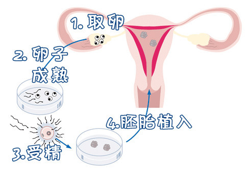 42岁二胎